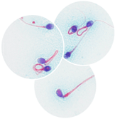 hautarztpraxis muenchen spermiogramme nach who